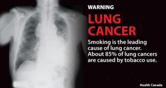 Lung cancer.jpg